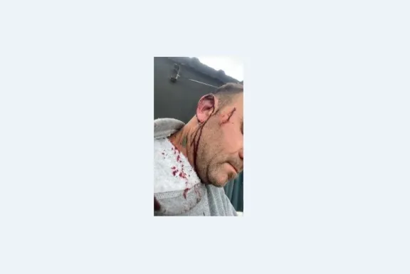 Agredieron al intendente de Pueblo Brugo